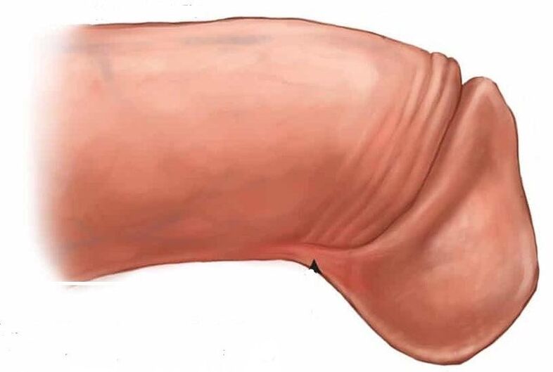 како да го зголемите глансот на пенисот